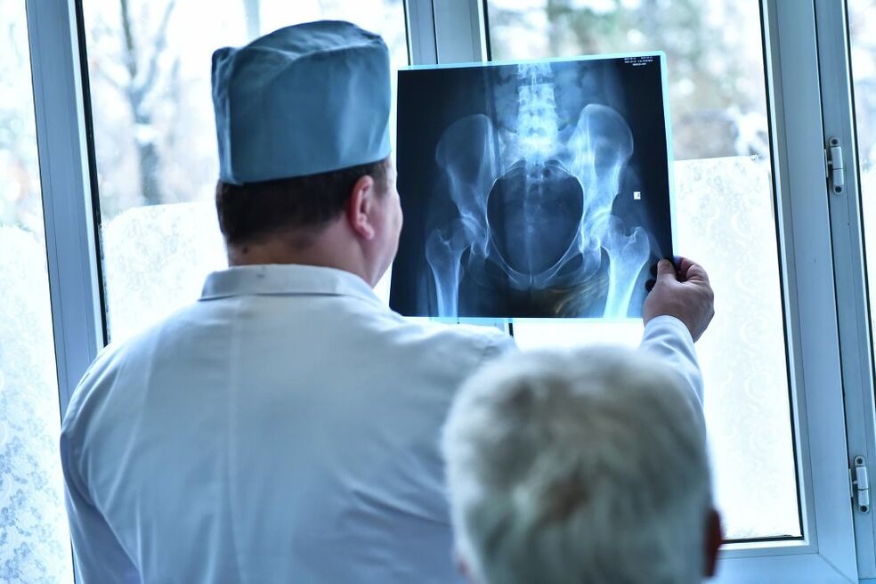 The doctor looks at a picture of a hip joint with arthrosis